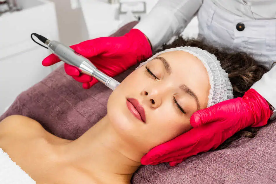 microneedling by Superior Self Aesthetics and Wellness in Holmdel, NJ